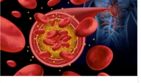 Cholesterol Explained: Good, Bad & What It Means for Your Heart