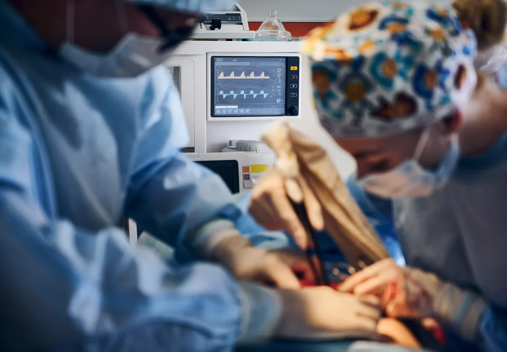 Coronary Angiography Test Bangalore